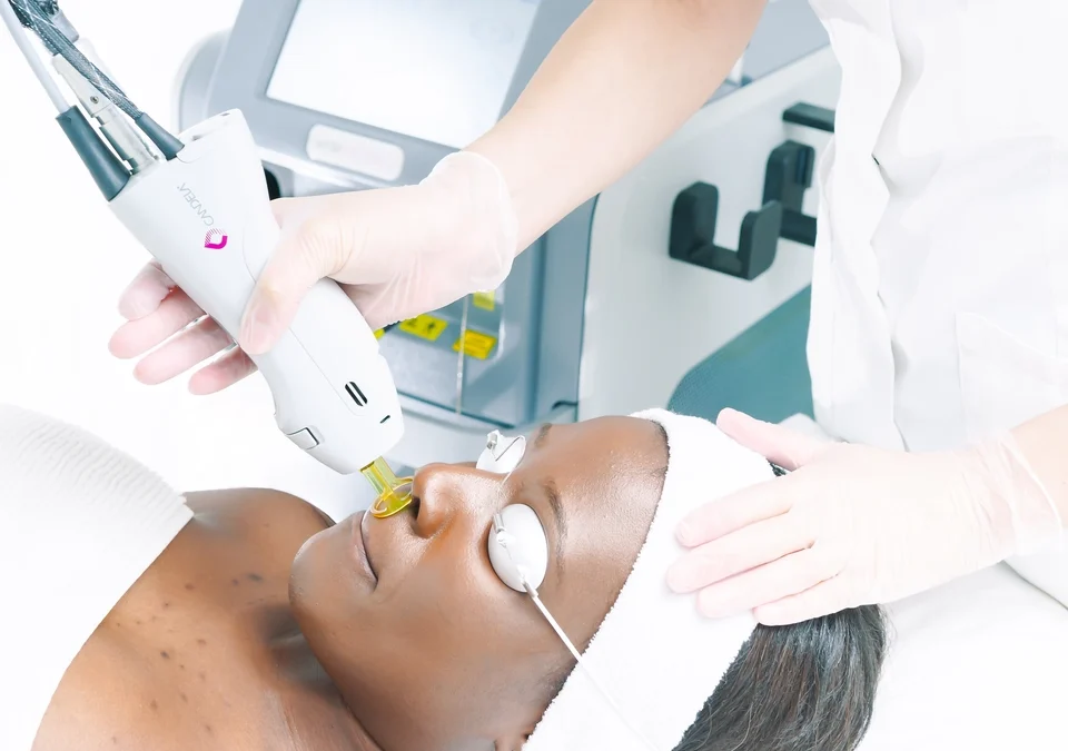 What’s The Ideal Age For Laser Hair Removal?