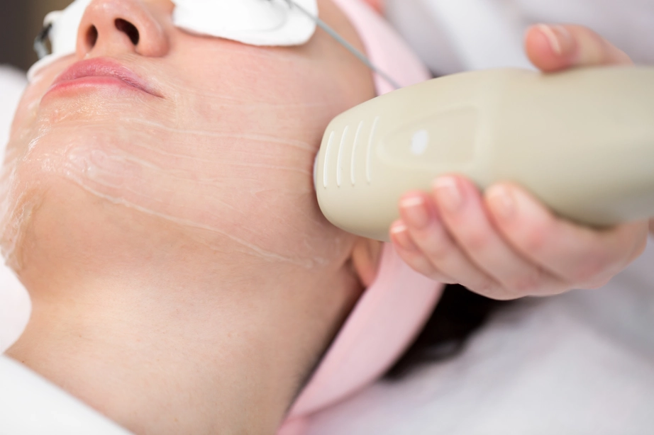 Is It Safe To Get Laser Hair Removal On Your Face?